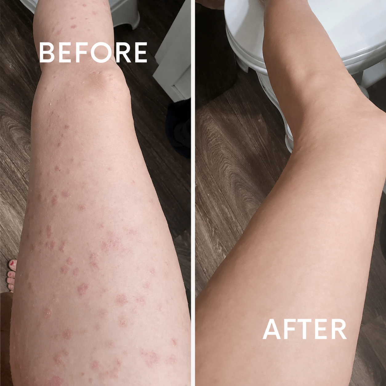 Derin Peeling Eldiveni | Ölü Deriyi Arındıran Banyo Eldiveni