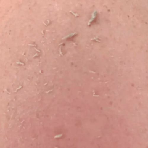 Derin Peeling Eldiveni | Ölü Deriyi Arındıran Banyo Eldiveni